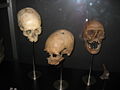 Nationalmuseet København - Kranier fra bondestenalderen.jpg