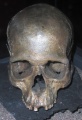 Knaggårdens gånggrift, Luttra, manskranium 6392.jpg